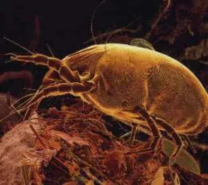 Close up delle punture degli acari del letto sullepidermide umana, evidenza del noto impatto degli acari visibili sullambiente umano
