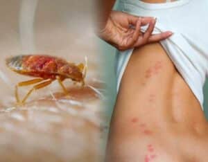 Disinfestazione delle cimici da letto nel Veneto scopri come prevenire e trattare linfestazione