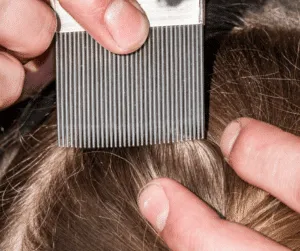 Immagine di bambini che soffrono di infestazione da pidocchi, con informazioni su come prevenire linfestazione da pidocchi