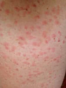 Macro immagine di un acaro della polvere che infetta un tessuto, riferimento prezzi disinfestazione acari