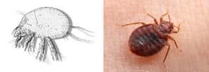 Macro di una pelle infestata da punture di acaro, correlato allargomento delle differenze tra acari della polvere e acari del legno