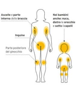 Immagine di una zecca individuata in casa, nellambito di un articolo su come identificare le zecche